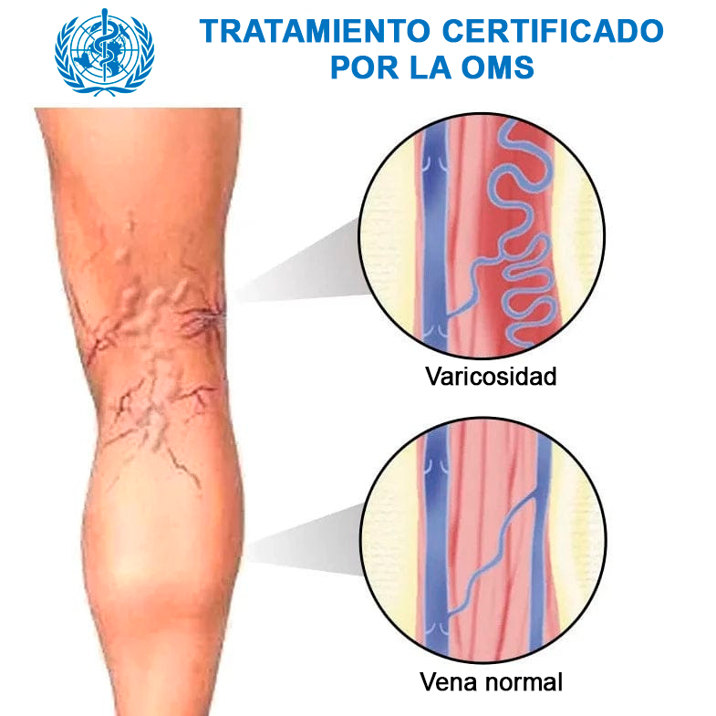 Veins Parche Anti-varices [COMPRE 6, LEVE 12🎁]